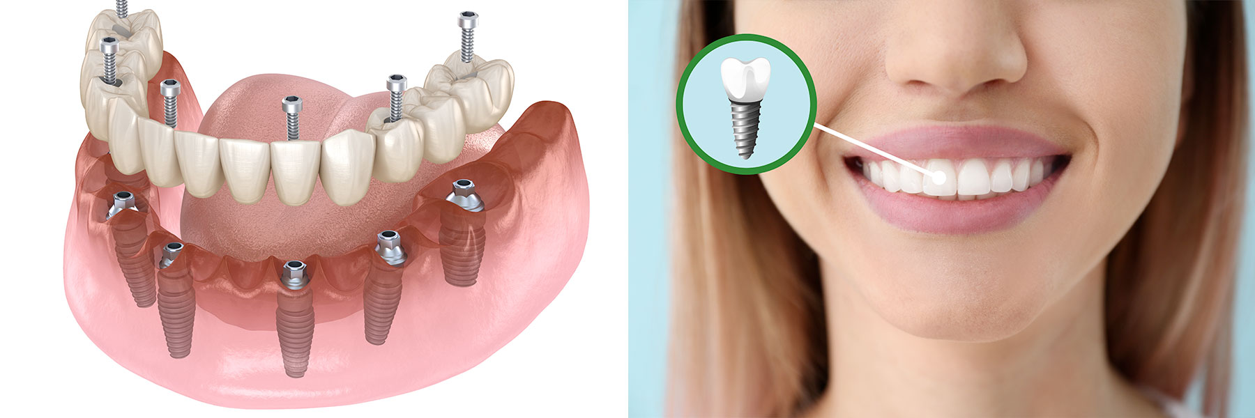 DENTISTERIE GÉNÉRALE, URGENCES DENTAIRES